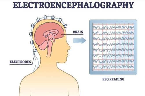 Eeg Electroencephalography Mind And Sex Clinic